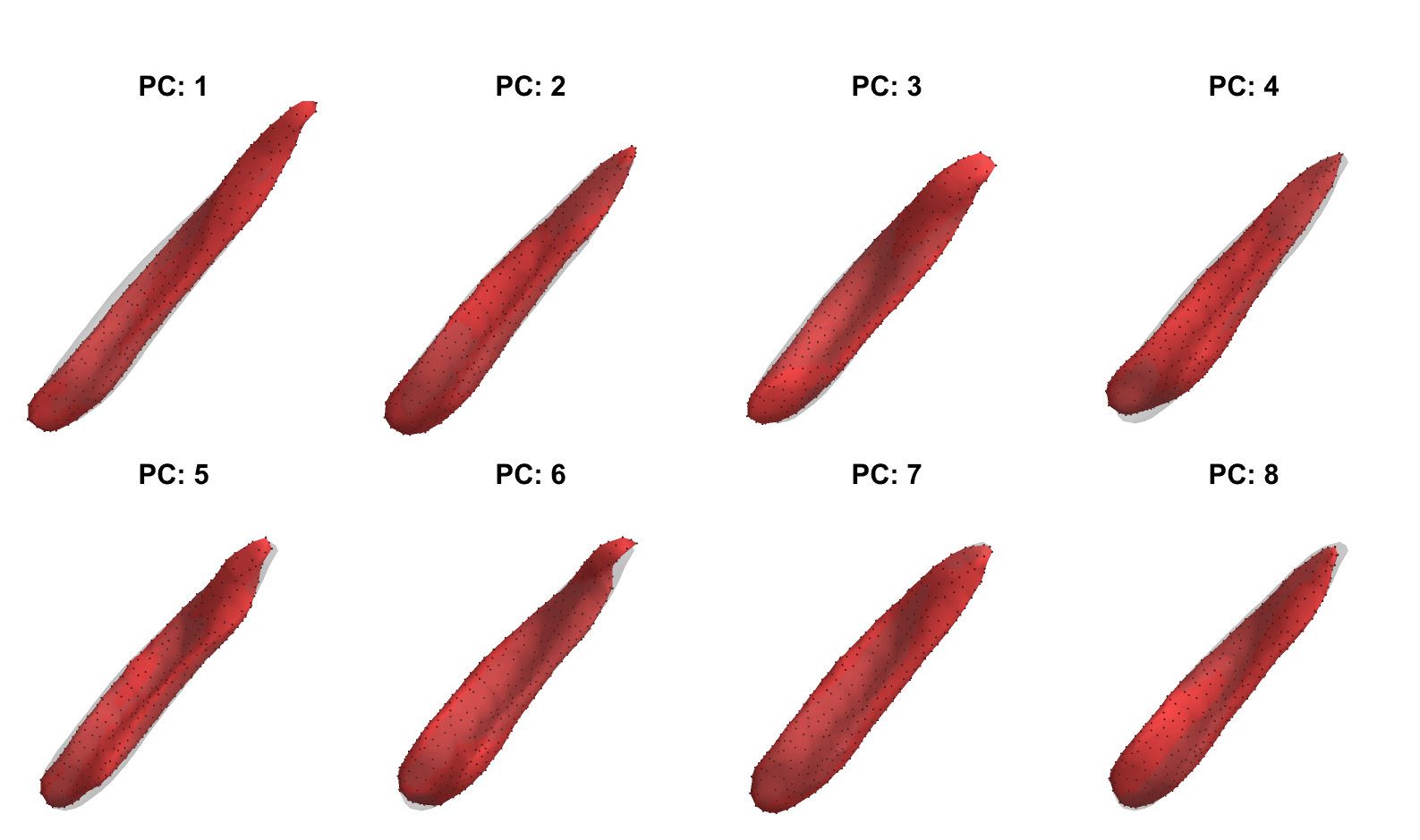 statistical shape model of the Vastus medialis.