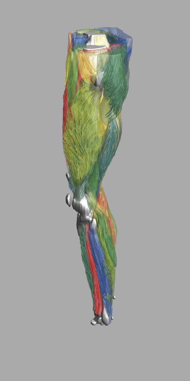 whole leg muscles fiber tractography