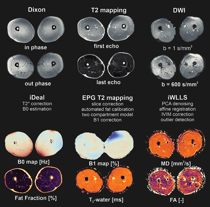 Quantitative muscle MRI processing